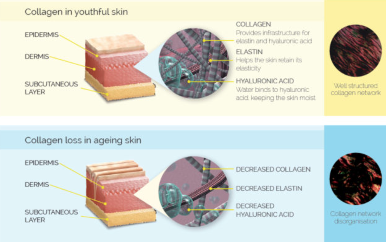 Skin Collagen Loss