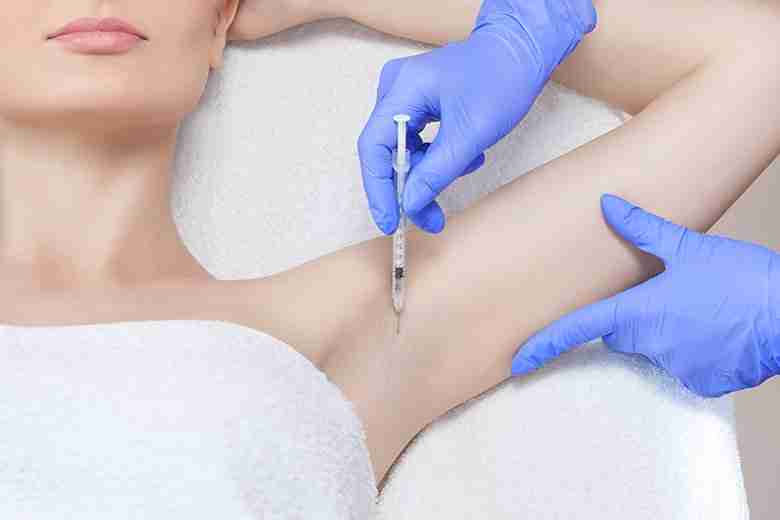 Excessive Sweating fillers