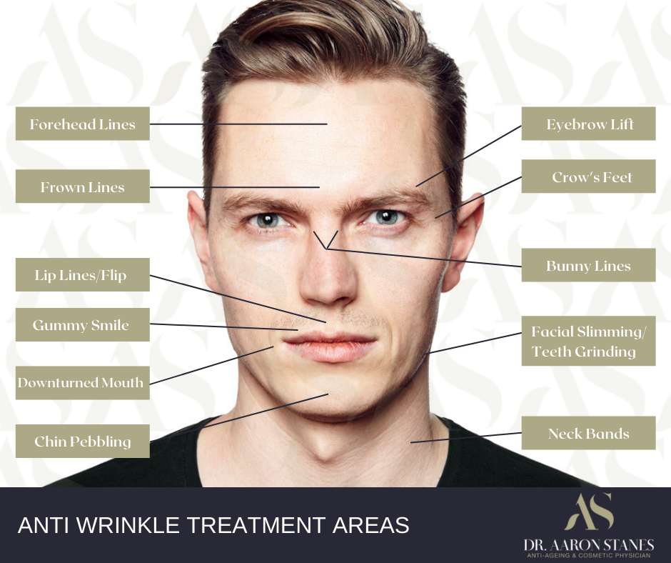 Anti-wrinkle treatment areas